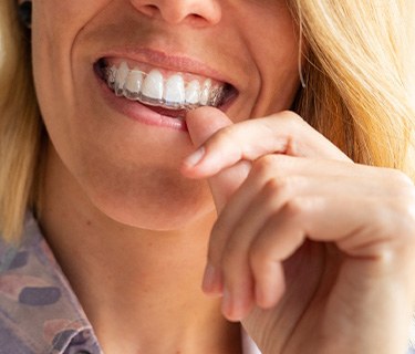 Blonde woman placing Invisalign aligner on upper teeth