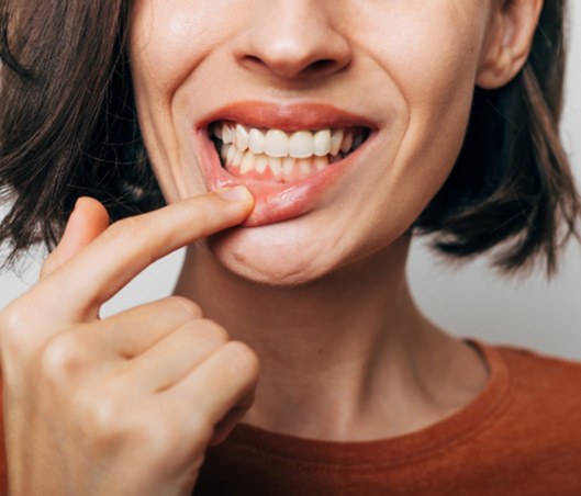 a woman pointing to her gums