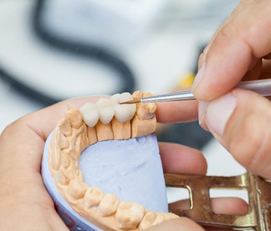 a dental technician making a bridge