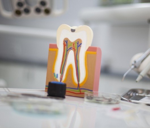Model of a tooth showing inner nerve pathways that are treated during root canal treatment in Fort Worth