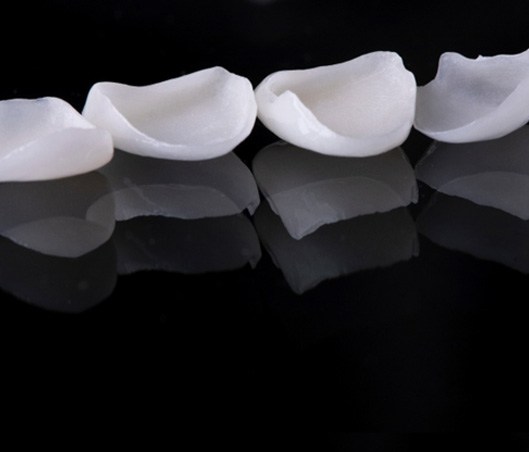 Several veneers on a reflective black surface