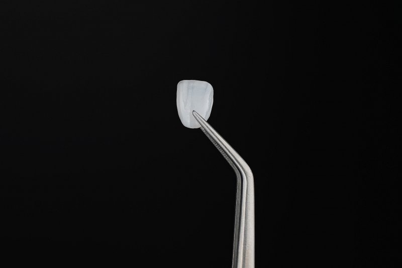 Veneer held with tweezer